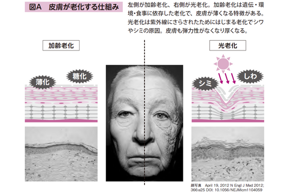 最も老化の原因となるのは太陽ですか?
