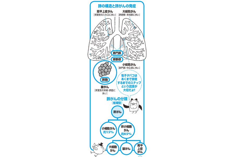 肺の構造と肺がんの発症『眠れなくなるほど面白い 図解 病理学の話』