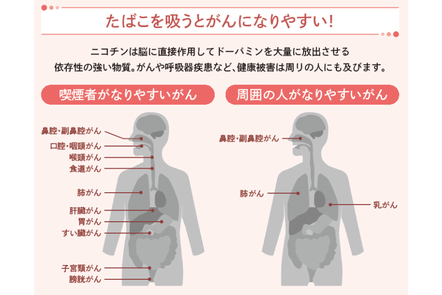 喫煙者がなりやすいがん『短時間でしっかりわかる　図解　依存症の話』