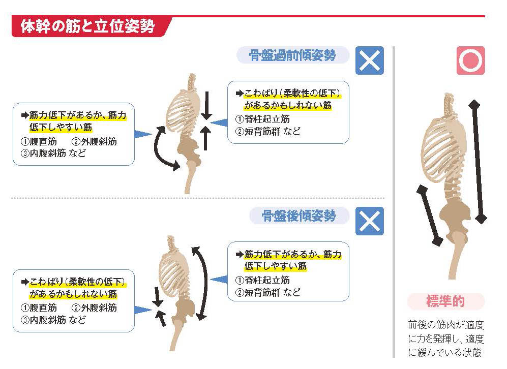 体幹の筋と立位姿勢【スポーツ障害予防の教科書】