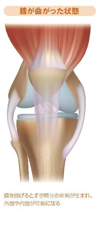 膝が曲がった状態【スポーツ障害予防の教科書】