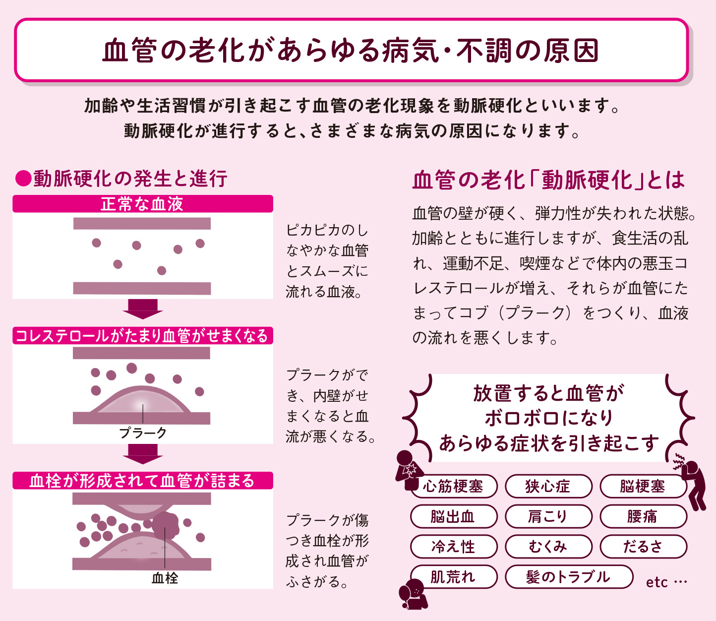 ４人に1人が要介護になる時代、その原因は血管と血液の老化【図解 血管・血液の話】