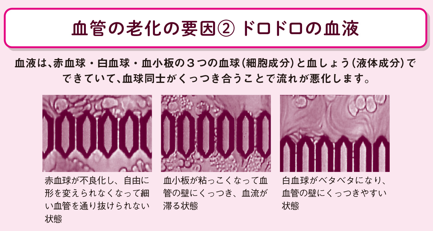 老けた血管は古くなったホース【図解 血管・血液の話】