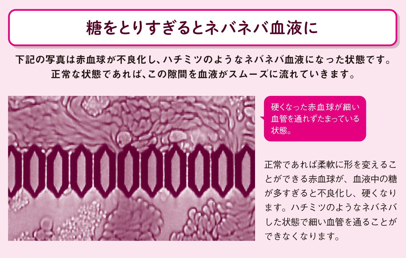 「高血糖」の人の血液はネバネバタイプ【図解 血管・血液の話】