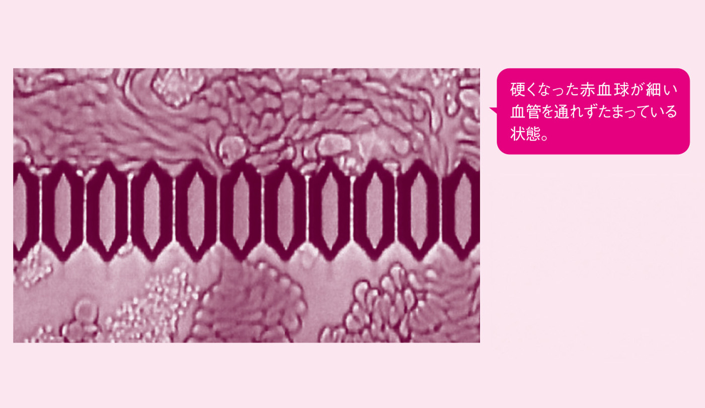 青い爪を引き起こす条件