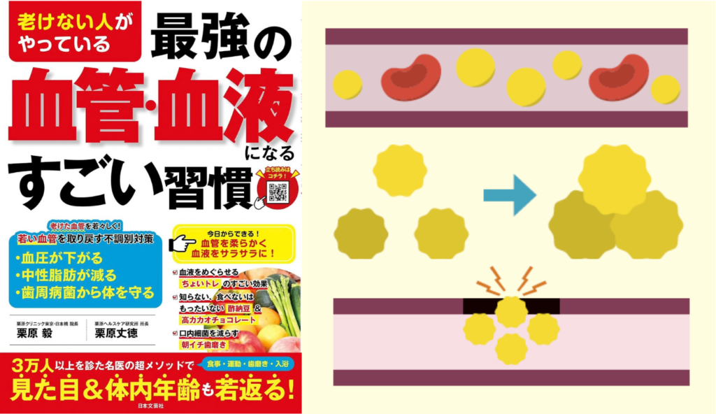 血流悪化や血管傷つけの原因に！中性脂肪過多が引き起こす「ザラザラ血液」のメカニズム【老けない人がやっている最強の血管・血液になるすごい習慣】
