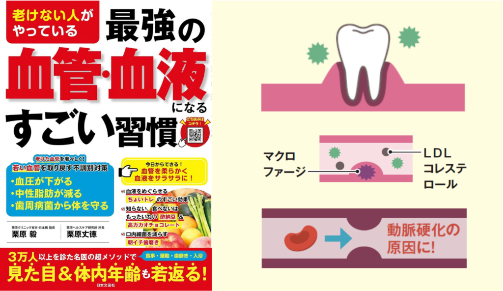 歯周病菌が血管に入り動脈硬化の原因に！『老けない人がやっている最強の血管・血液になるすごい習慣』に学ぶ口腔ケアの重要性
